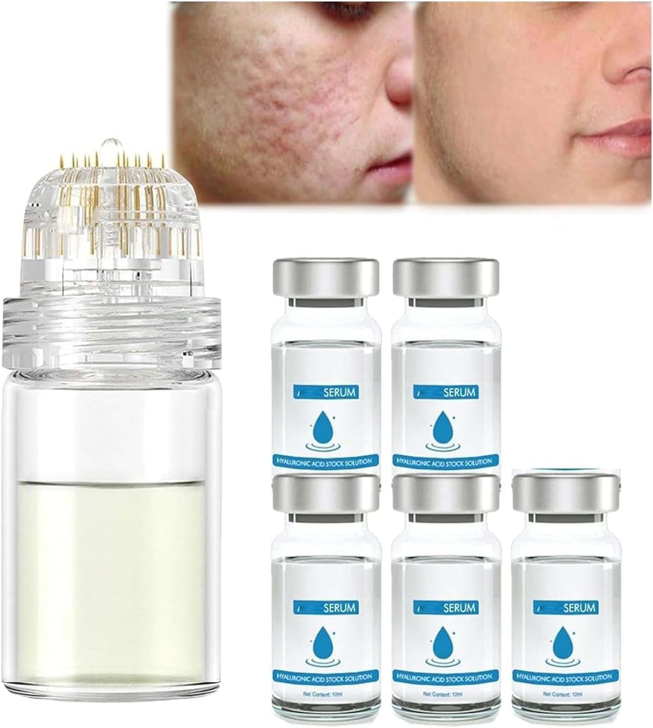 Système De Micro-Perfusion Pour Les Lèvres, Micro Système Pour Le Visage, Système Facial Avec Sérum, Rouleau De Microfléchettes À L'Acide Hyaluronique Pockmarksheal, Sérum Pour Peau Lisse (3 Pièces)