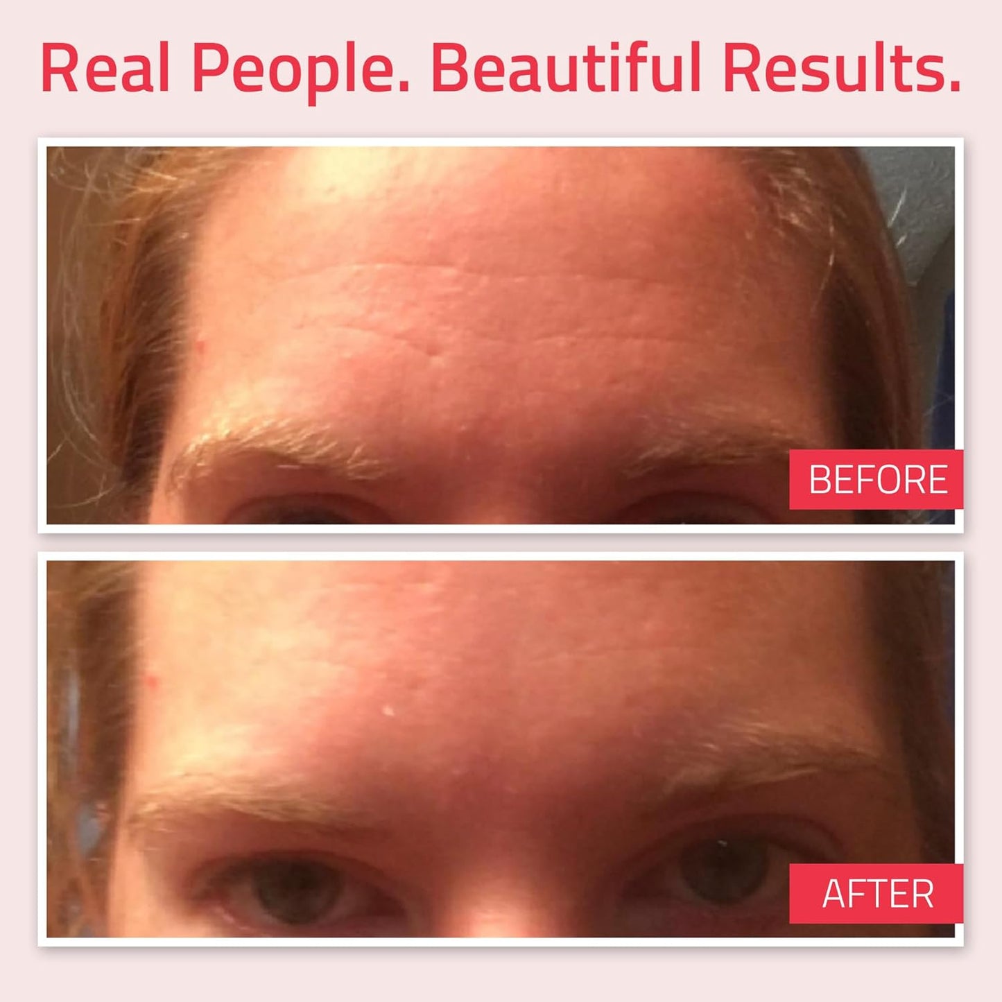 YEOUTH Retinol Serum Visage Avec Acide Hyaluronique, Vitamine E Et Aloe Vera, Hydratant Sérum Visage Nuit Adapté À Tous Les Types De Peau 30Ml