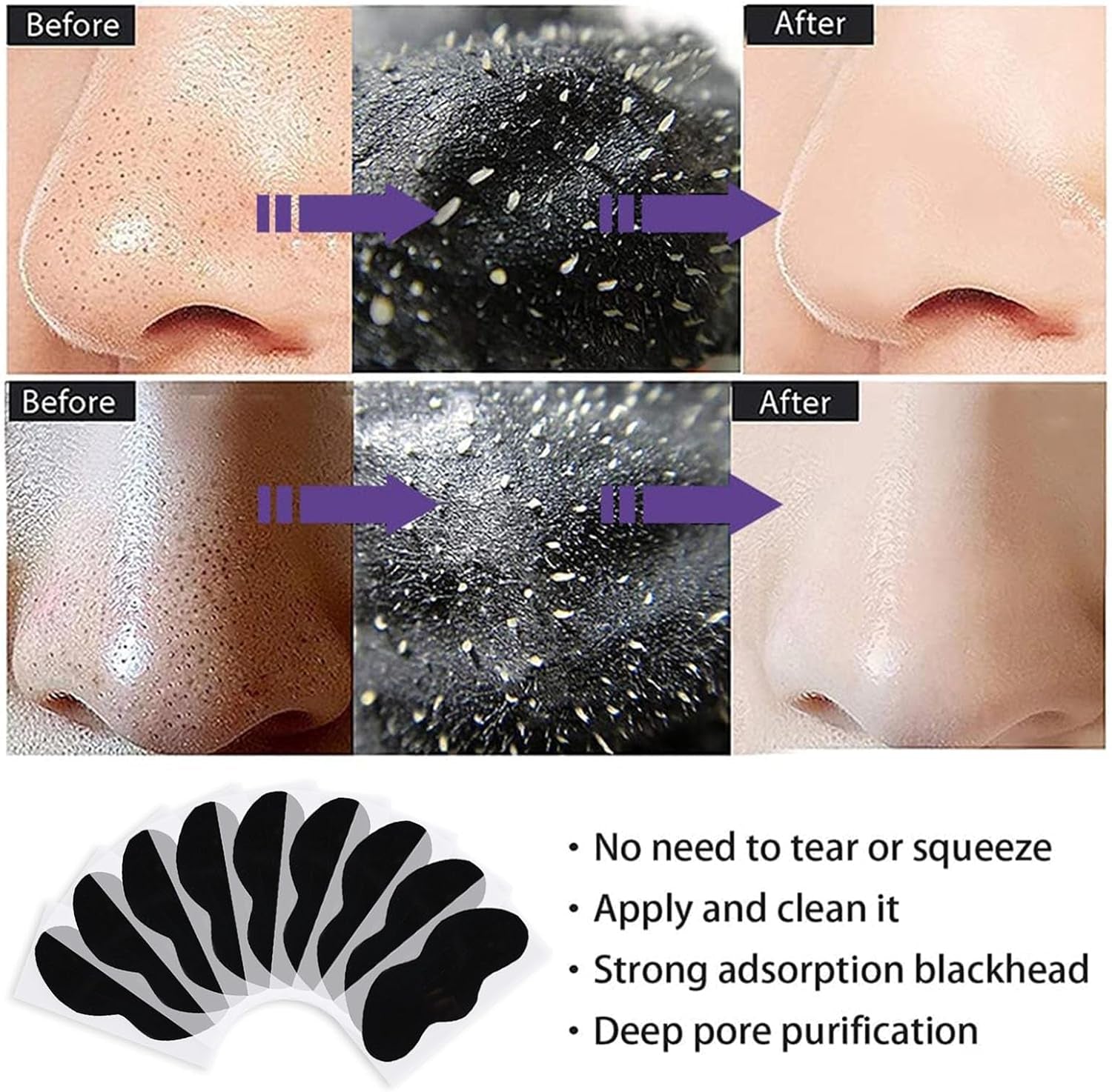 Truume Patch Point Noir, Patches Point Noir Nez, Patch Point Noir Visage, Patch anti Point Noir Nez Visage, Patch Point Noir Nez, Élimine Les Points Noirs Et Les Impuretés, 25 Pcs