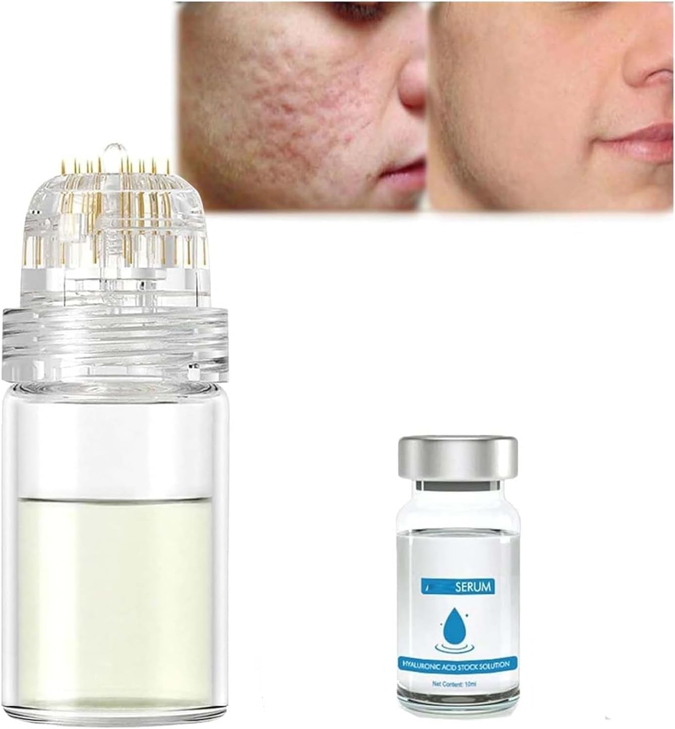 Système De Micro-Perfusion Pour Les Lèvres, Micro Système Pour Le Visage, Système Facial Avec Sérum, Rouleau De Microfléchettes À L'Acide Hyaluronique Pockmarksheal, Sérum Pour Peau Lisse (3 Pièces)