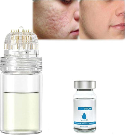 Système De Micro-Perfusion Pour Les Lèvres, Micro Système Pour Le Visage, Système Facial Avec Sérum, Rouleau De Microfléchettes À L'Acide Hyaluronique Pockmarksheal, Sérum Pour Peau Lisse (3 Pièces)