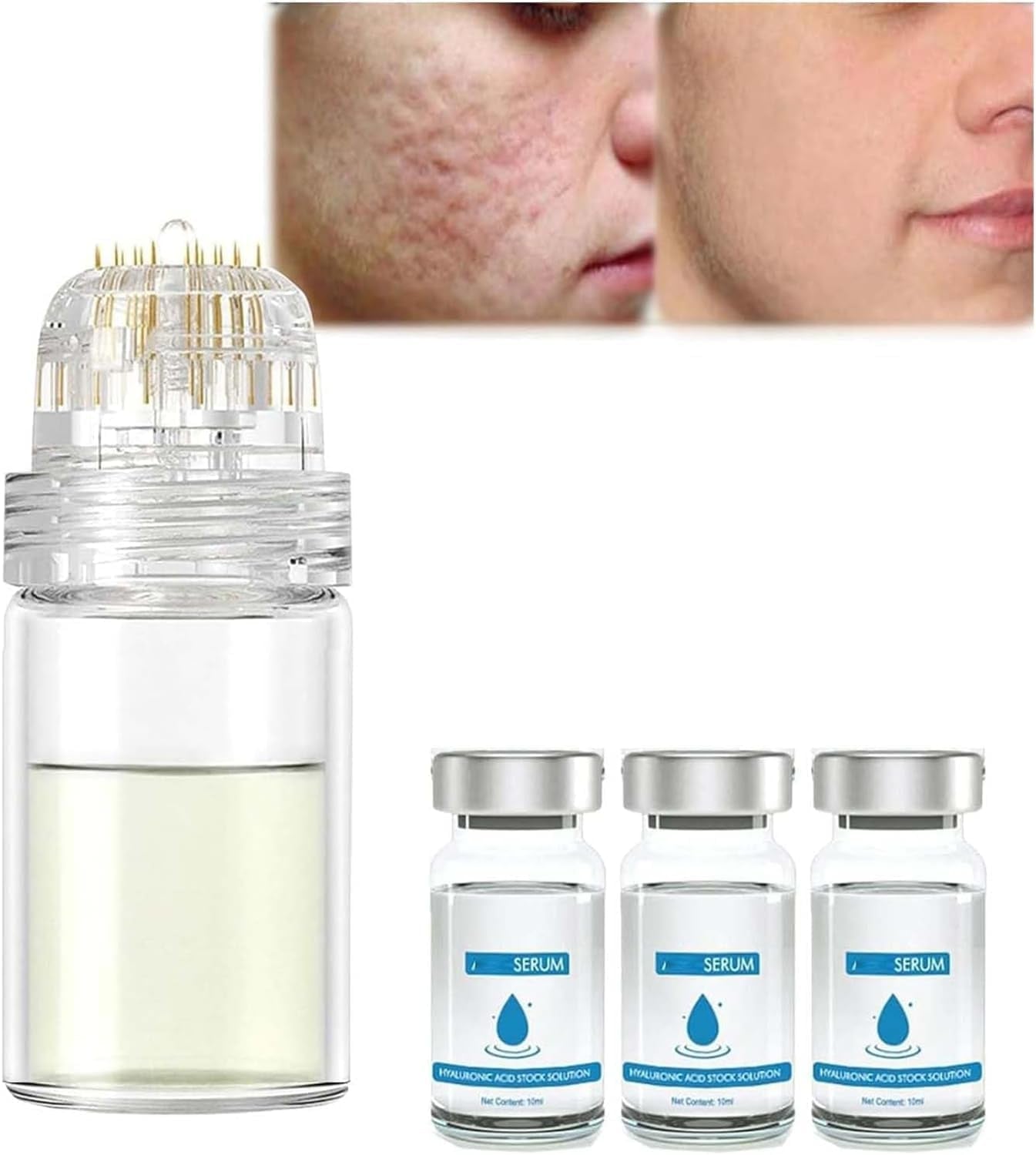 Système De Micro-Perfusion Pour Les Lèvres, Micro Système Pour Le Visage, Système Facial Avec Sérum, Rouleau De Microfléchettes À L'Acide Hyaluronique Pockmarksheal, Sérum Pour Peau Lisse (3 Pièces)