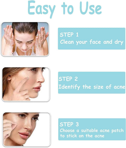 Rnitle Acné Patch,180 Patchs Pimple Patch,12Mm & 8Mm Patch Bouton Acne,Anti-Acné Patch, Patch Bouton, Autocollants Pour Boutons, Patch Invisible, Pour Soin De La Peau